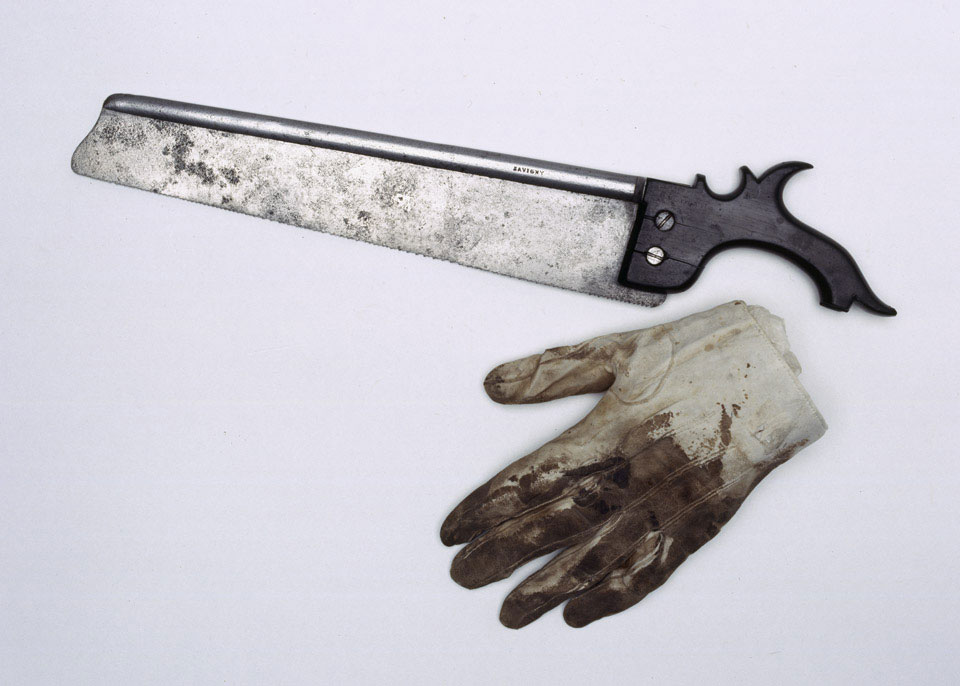 Saw used to amputate the Earl of Uxbridge’s leg at Waterloo, 1815